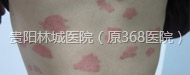 缲-ط